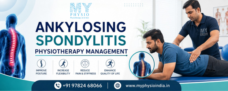 anykylosing spondylitis physiotherapy management